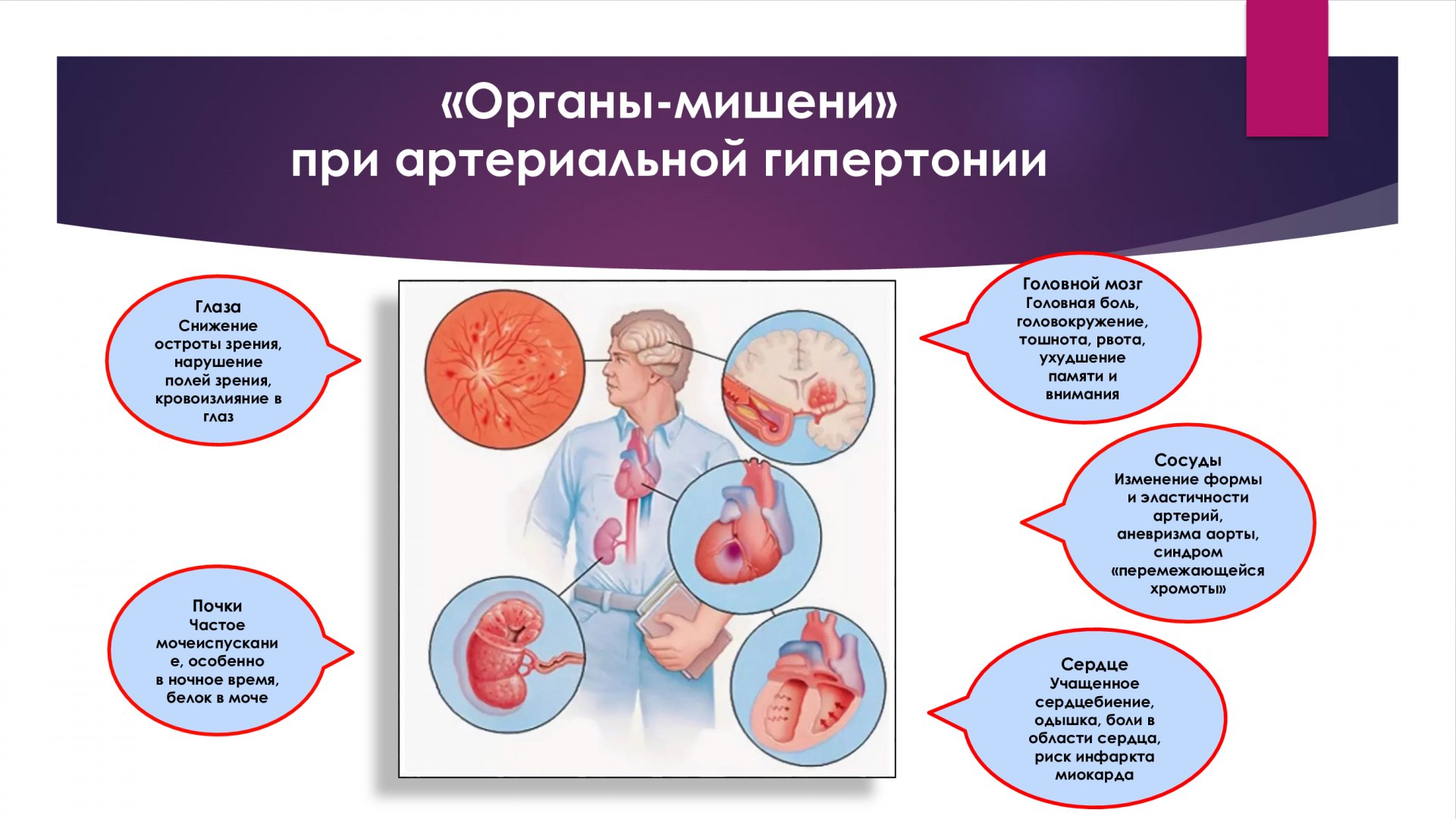 Стол 10 при гипертонической болезни сердца